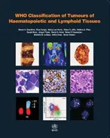 Classificazione OMS dei tumori dei tessuti ematopoietici e linfoidi - WHO Classification of Tumours of Haematopoietic and Lymphoid Tissues