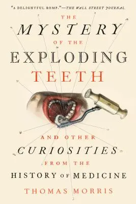 Il mistero dei denti che esplodono: E altre curiosità della storia della medicina - The Mystery of the Exploding Teeth: And Other Curiosities from the History of Medicine