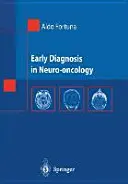 Diagnosi precoce in neuro-oncologia - Early Diagnosis in Neuro-Oncology