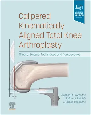Artroplastica totale di ginocchio allineata cinematicamente: Teoria, tecniche chirurgiche e prospettive - Calipered Kinematically Aligned Total Knee Arthroplasty: Theory, Surgical Techniques and Perspectives