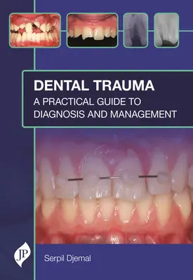 Trauma dentale: Guida pratica alla diagnosi e alla gestione - Dental Trauma: A Practical Guide to Diagnosis and Management