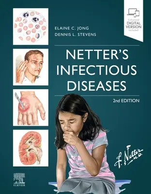 Malattie infettive di Netter - Netter's Infectious Diseases
