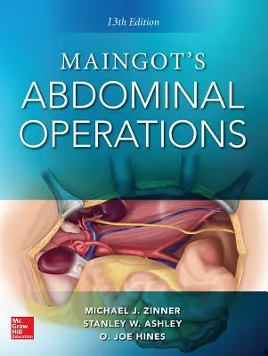 Operazioni addominali di Maingot. 13a edizione - Maingot's Abdominal Operations. 13th Edition
