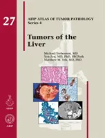 Tumori del fegato - Tumors of the Liver