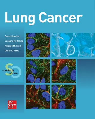 Cancro al polmone: Standard di cura - Lung Cancer: Standards of Care