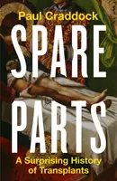 Pezzi di ricambio - Una sorprendente storia di trapianti - Spare Parts - A Surprising History of Transplants