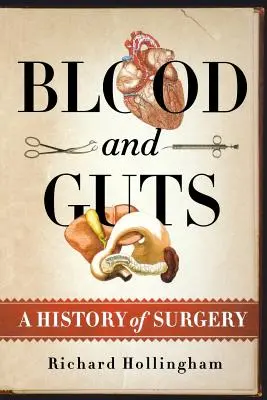 Sangue e budella: Storia della chirurgia - Blood and Guts: A History of Surgery