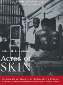 Acri di pelle: Esperimenti umani nella prigione di Holmesburg - Acres of Skin: Human Experiments at Holmesburg Prison