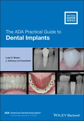 La guida pratica dell'ADA agli impianti dentali - The ADA Practical Guide to Dental Implants