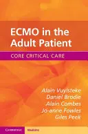 ECMO nel paziente adulto - ECMO in the Adult Patient