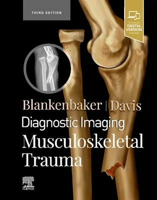 Diagnostica per immagini: Trauma muscoloscheletrico - Diagnostic Imaging: Musculoskeletal Trauma