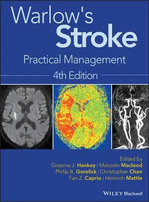 L'ictus di Warlow: Gestione pratica - Warlow's Stroke: Practical Management