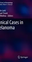 Casi clinici di melanoma - Clinical Cases in Melanoma