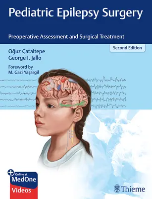 Chirurgia dell'epilessia pediatrica: Valutazione preoperatoria e trattamento chirurgico - Pediatric Epilepsy Surgery: Preoperative Assessment and Surgical Treatment