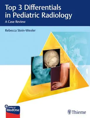 Le 3 principali diagnosi differenziali in radiologia pediatrica: Una rassegna di casi - Top 3 Differentials in Pediatric Radiology: A Case Review