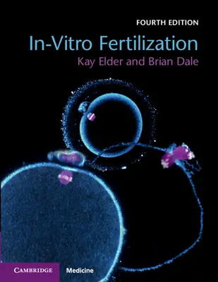 Fecondazione in vitro - In-Vitro Fertilization