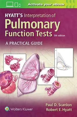L'interpretazione dei test di funzionalità polmonare di Hyatt - Hyatt's Interpretation of Pulmonary Function Tests