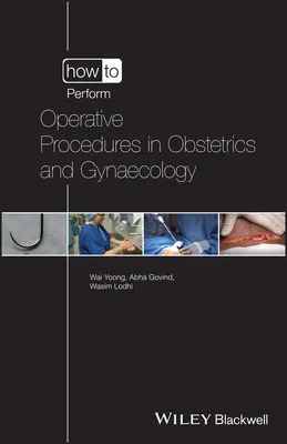 Come eseguire procedure operative in ostetricia e ginecologia - How to Perform Operative Procedures in Obstetrics and Gynaecology