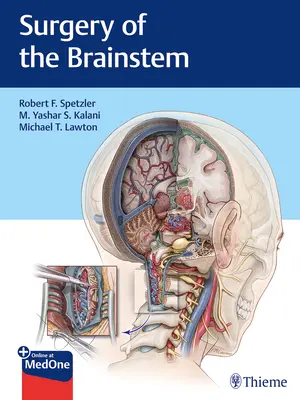 Chirurgia del tronco encefalico - Surgery of the Brainstem