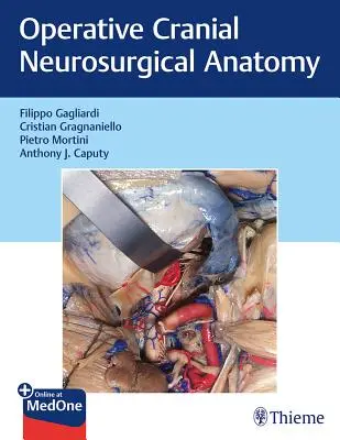 Anatomia Operativa Neurochirurgica Craniale - Operative Cranial Neurosurgical Anatomy