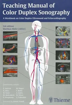 Manuale di insegnamento della sonografia duplex a colori - Teaching Manual of Color Duplex Sonography