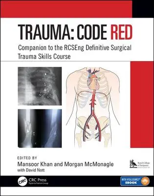 Trauma: Codice rosso: Compagno del corso definitivo di traumatologia chirurgica Rcseng - Trauma: Code Red: Companion to the Rcseng Definitive Surgical Trauma Skills Course