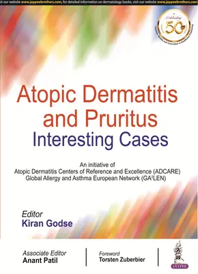 Dermatite atopica e prurito - Atopic Dermatitis and Pruritus