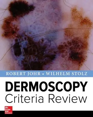 Revisione dei criteri di dermoscopia - Dermoscopy Criteria Review