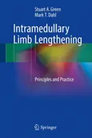 Allungamento intramidollare degli arti: Principi e pratica - Intramedullary Limb Lengthening: Principles and Practice