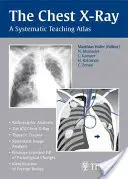 La radiografia del torace: Atlante didattico sistematico - The Chest X-Ray: A Systematic Teaching Atlas