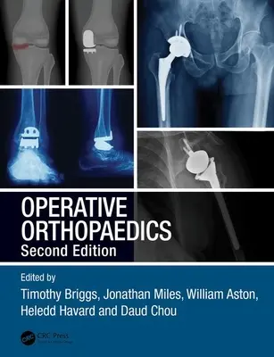 Ortopedia operativa - Operative Orthopaedics