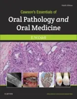 Essenziali di patologia orale e medicina orale di Cawson - Cawson's Essentials of Oral Pathology and Oral Medicine