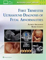 Diagnosi ecografica del primo trimestre delle anomalie fetali - First Trimester Ultrasound Diagnosis of Fetal Abnormalities