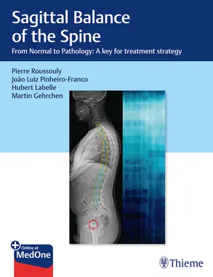 Equilibrio sagittale della colonna vertebrale: Dalla normalità alla patologia: Una chiave per la strategia di trattamento - Sagittal Balance of the Spine: From Normal to Pathology: A Key for Treatment Strategy