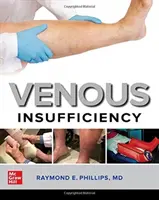 Insufficienza venosa - Venous Insufficiency