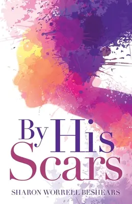 Per le sue cicatrici - By His Scars