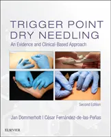 Dry Needling dei punti trigger: Un approccio basato sull'evidenza e sulla clinica - Trigger Point Dry Needling: An Evidence and Clinical-Based Approach