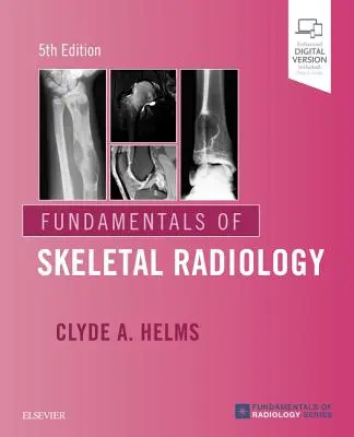 Fondamenti di radiologia scheletrica - Fundamentals of Skeletal Radiology