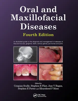Malattie orali e maxillo-facciali, quarta edizione - Oral and Maxillofacial Diseases, Fourth Edition
