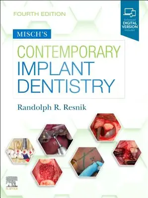 Odontoiatria implantare contemporanea di Misch - Misch's Contemporary Implant Dentistry