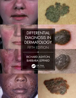 Diagnosi differenziale in dermatologia - Differential Diagnosis in Dermatology