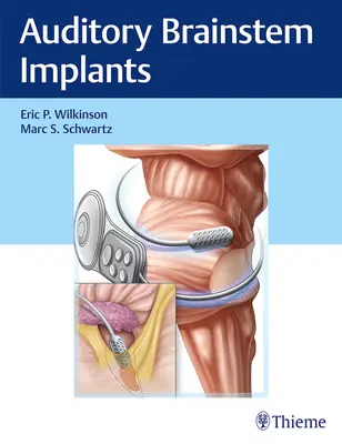 Impianti del tronco cerebrale uditivo - Auditory Brainstem Implants