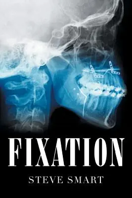 Fissazione - Fixation