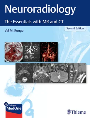 Neuroradiologia: Gli elementi essenziali con RM e TC - Neuroradiology: The Essentials with MR and CT