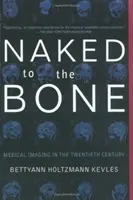 Nudi fino all'osso: le immagini mediche nel ventesimo secolo - Naked to the Bone: Medical Imaging in the Twentieth Century