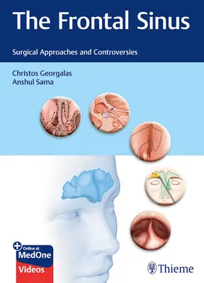 Il seno frontale: Approcci chirurgici e controversie - The Frontal Sinus: Surgical Approaches and Controversies
