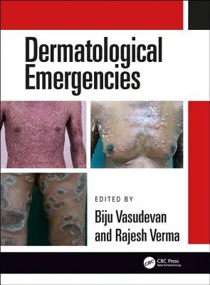 Emergenze dermatologiche - Dermatological Emergencies