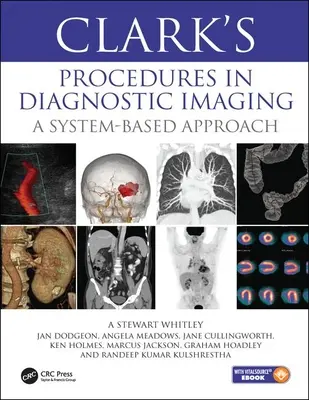 Le procedure di Clark nella diagnostica per immagini - Un approccio basato sul sistema - Clark's Procedures in Diagnostic Imaging - A System-Based Approach