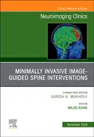 Intervento sulla colonna vertebrale, un numero di Neuroimaging Clinics of North America - Spine Intervention, An Issue of Neuroimaging Clinics of North America