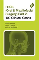Frcs (Chirurgia orale e maxillo-facciale) parte 2: 100 casi clinici - Frcs (Oral & Maxillofacial Surgery) Part 2: 100 Clinical Cases